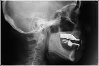 骨格の形態を調べる